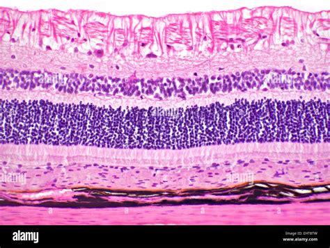 Cat Eye Retina Detail Brightfield Photomicrograph Stained Section