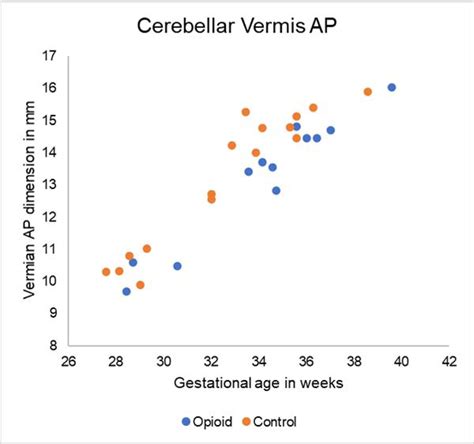 Pilot Study Of Fetal Brain Development And Morphometry In Prenatal