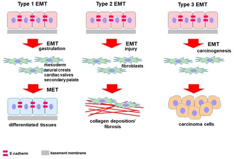 Cells Free Full Text E Cadherin In Pancreatic Ductal Adenocarcinoma