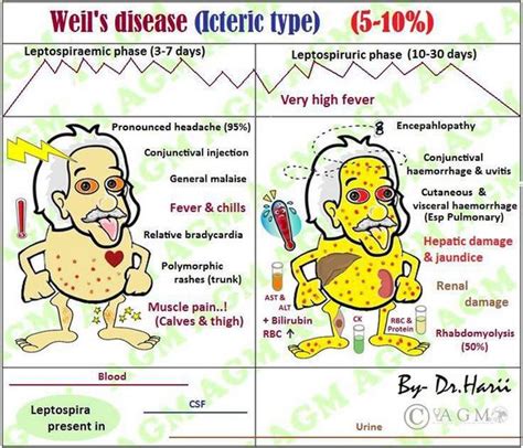 Weils Diseasewhat To Know