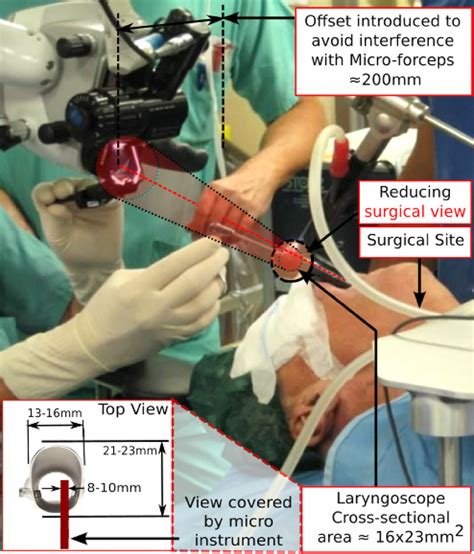 Dimensional Requirements Of Microsurgical Forceps In Tlm Download Scientific Diagram