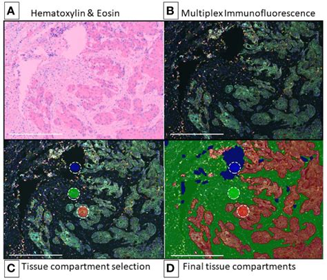 Frontiers Multiplex Immunofluorescence And The Digital Image Analysis