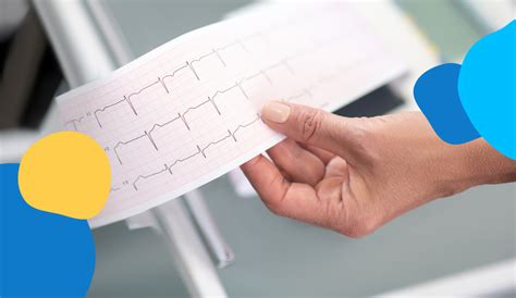 Elettrocardiogramma ECG Quando Farlo Doctolib