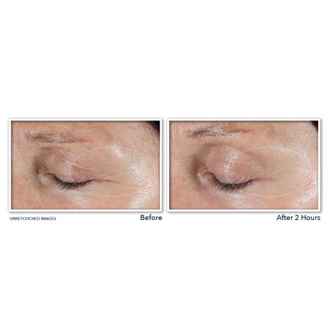 Buy RoC Retinol Correxion Deep Wrinkle Non-Invasive Targeted Patches