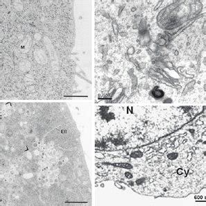 Ultrastructural Changes In Cells Infected With Viruses That Are