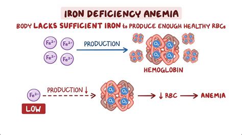 Iron Deficiency Anemia Video And Meaning Osmosis