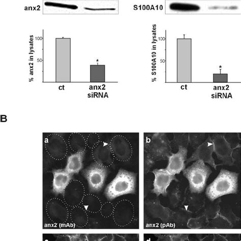 Annexin 2 Gene Silencing Specifically Alters The Distribution Of