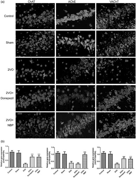 Dl 3 N Butylphthalide Regulates Cholinergic Dysfunction In Chronic