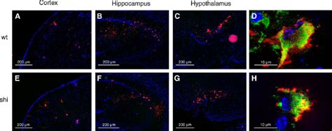 Viral Antigens In The Brain Of Wild Type And Shiverer Mice Mice Were