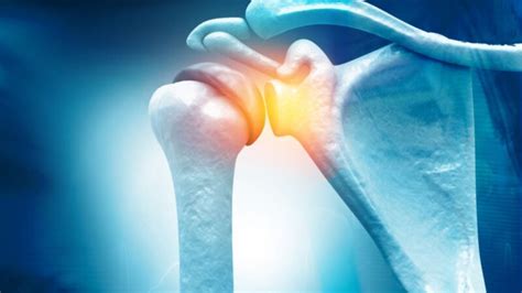 Frozen Shoulder Physiotherapy Treatment Propel Physiotherapy