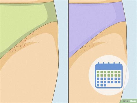 How To Get Rid Of Razor Bumps In The Bikini Area Easy Tips