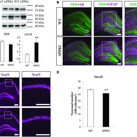 Examination Of Srr Expression Astrogliosis And Neuronal Number In The