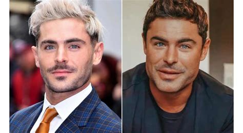 Zac Efron antes e depois procedimentos estéticos vida pessoal