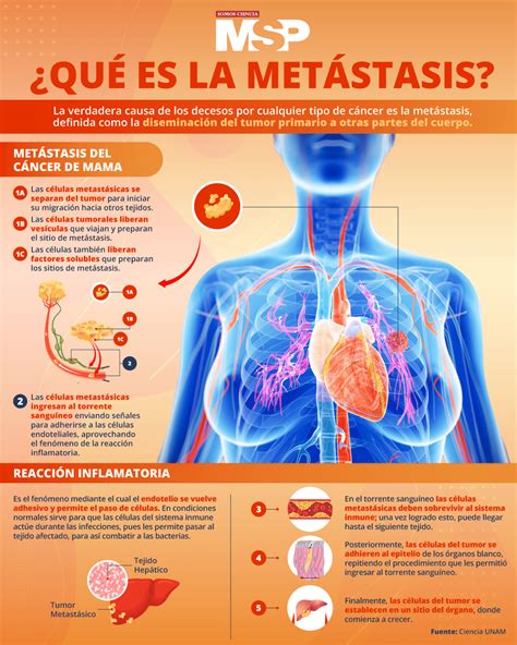 Qué es la metástasis Infografía