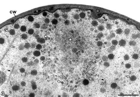 Near-median TEM section through hyphal tip of Botrytis cinerea... | Download Scientific Diagram