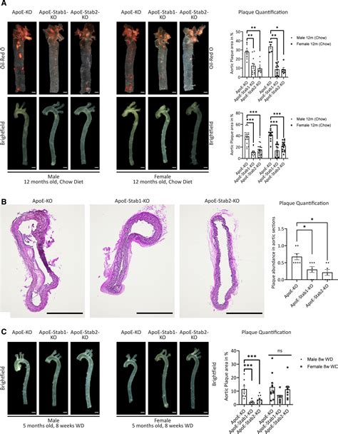 Targeting Of Scavenger Receptors Stabilin And Stabilin Ameliorates