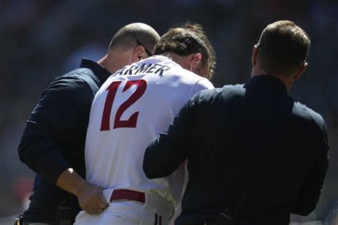 Twins Farmer Hit In Face By Mph Pitch Oral Surgery Next Abc