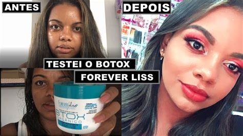 Vlog Testei O Botox Da Forever Liss Youtube