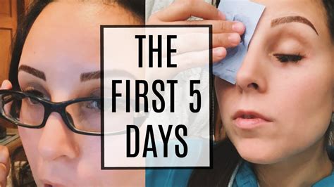 Microblading Healing Process The First 5 Days Youtube