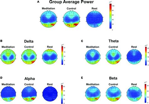 Scalp Topographic Maps Of Group N 21 Average Electroencephalography Download Scientific