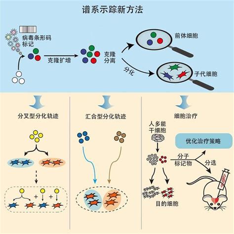 干细胞治疗帕金森病迎来新希望相关临床研究在瑞金医院启动