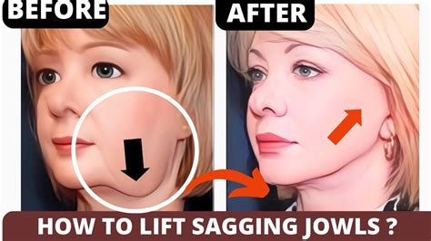 5 Minute Face Lifting Exercises For Sagging Jowls Saggy Cheeks