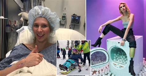 Woman Snowboards Again After Accident Led To Having Her Legs Amputated