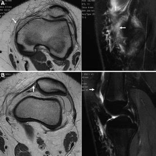 Axial Fast Spin Echo Magnetic Resonance Image With Cursor At Location