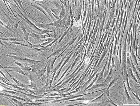 Cellvo Human Bone Marrow Mesenchymal Stem Cells Stembiosys