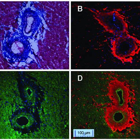 A And B Masson S Trichrome C Picrosirius Red Staining D Double Download Scientific Diagram