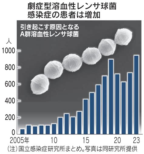 劇症型溶連菌の患者最多 致死率3割、感染力強い株確認 日本経済新聞