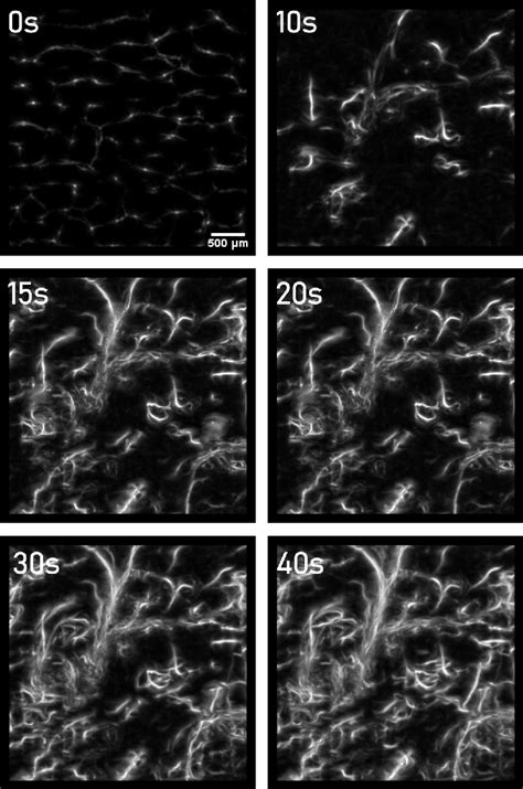 Figure 3 From Ultrasound Super Resolution Microvessel Imaging Via