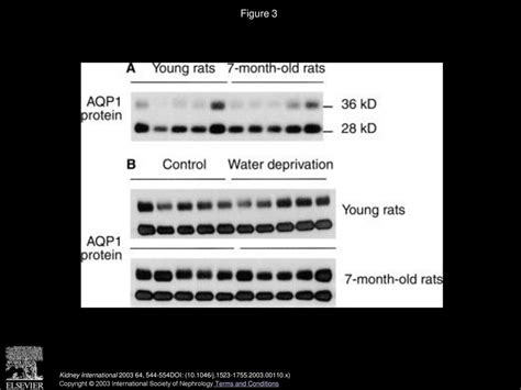 Resistance Of Mtal Na Dependent Transporters And Collecting Duct