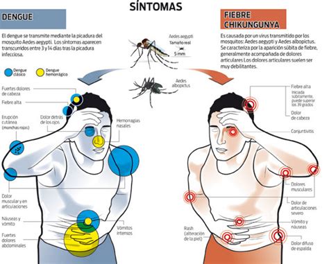 Fiebre Chikungunya Confirman Primer Caso De Paciente Con Dengue Y