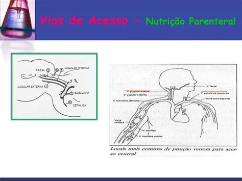 Nutri O Parenteral Disciplina De Sa De Do Adulto E Idoso Ppt Carregar