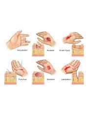 Types of Blood: Sanguineous, Serous, Purulent Fluids Comparision ...