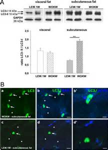 Expression Of Lc I And Lc Ii Proteins In Visceral Und Subcutaneous