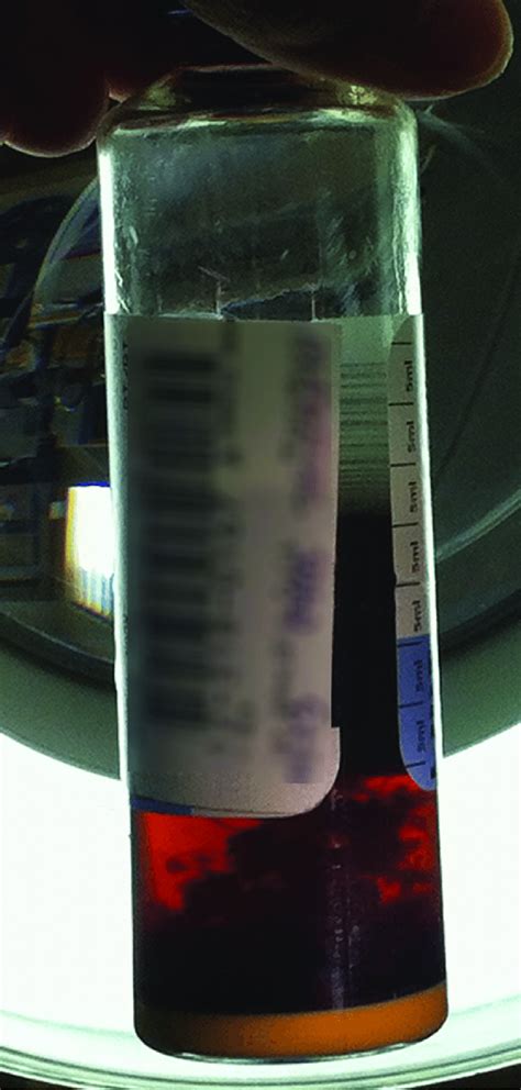 Fungal Blood Culture Bottles