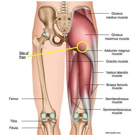 Upper hamstring pain