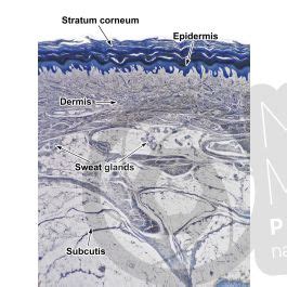 Man Sweat Gland Vertical Section X Sweat Gland Mammals