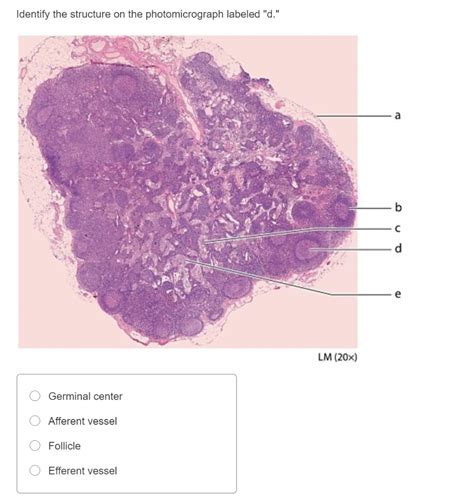 Solved Identify The Structure On The Photomicrograph Labeled Chegg