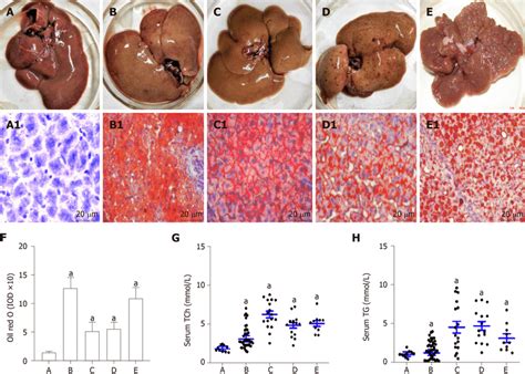 Rat Livers With Lipid Accumulation And Circulating Lipid Levels A The Download Scientific