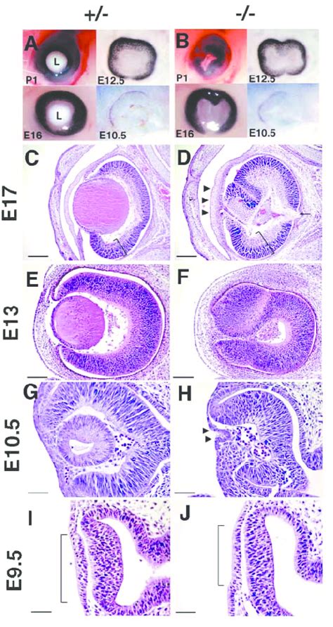 Histological And Morphological Analysis Of Eye Development In