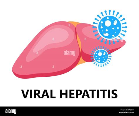 Viral Hepatitis A B C D Is Symbol Cirrhosis Icon World Hepatitis