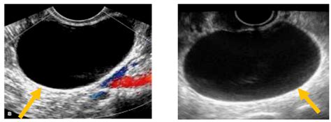 Diagnostics Free Full Text Advantages And Limitations Of Ultrasound