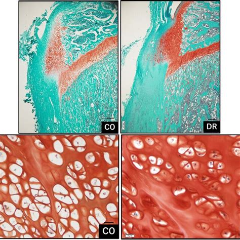 Morphometry Of Chondrocytes In The Deep Region The Chondrocyte Size In