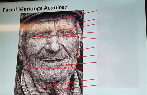 Acquired Facial Markings Diagram Quizlet