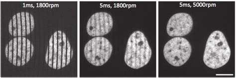 What Is Spinning Disk Confocal Microscopy?