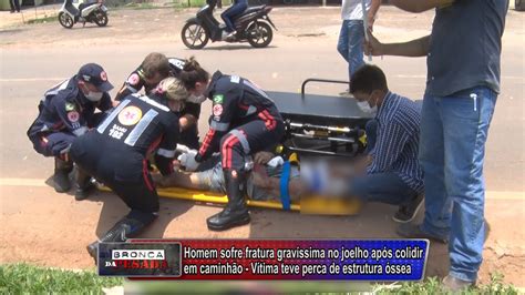 Motociclista Tem Fratura Exposta Após Grave Acidente Ao Colidir Com