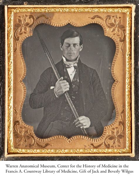 Phineas Gage — Vermont History Explorer